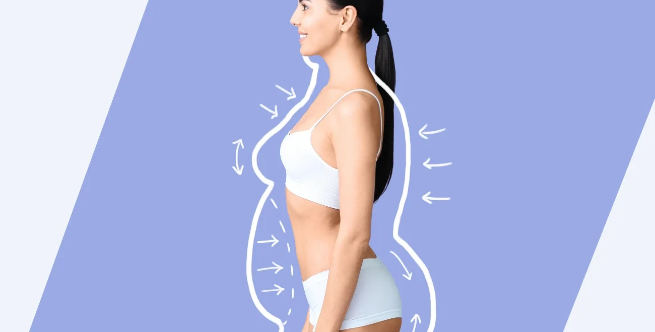 Paciente con obesidad en la consulta de Nutricion Bilbao