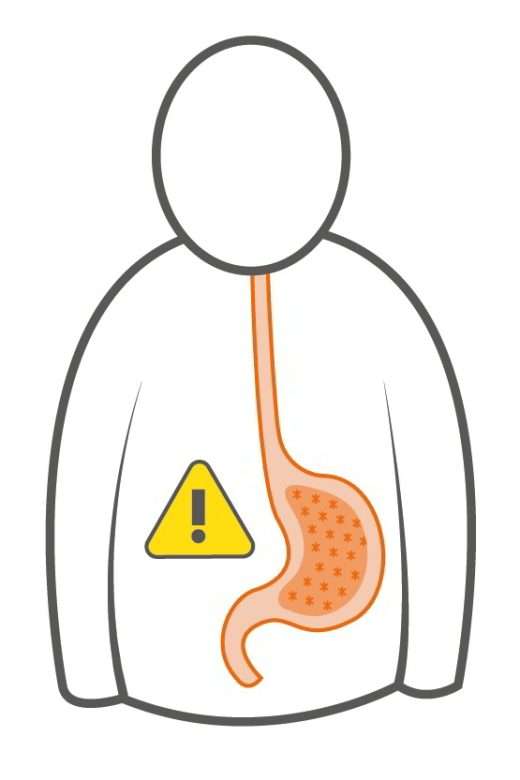 Ilustración de una persona con el estómago señalado con un icono de alerta por gastritis