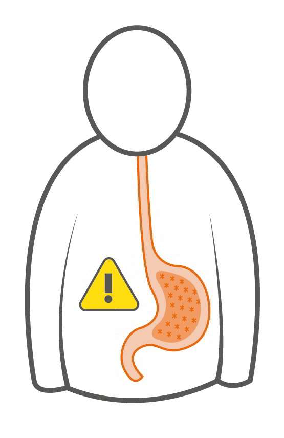 Ilustración de una persona con el estómago señalado con un icono de alerta por gastritis