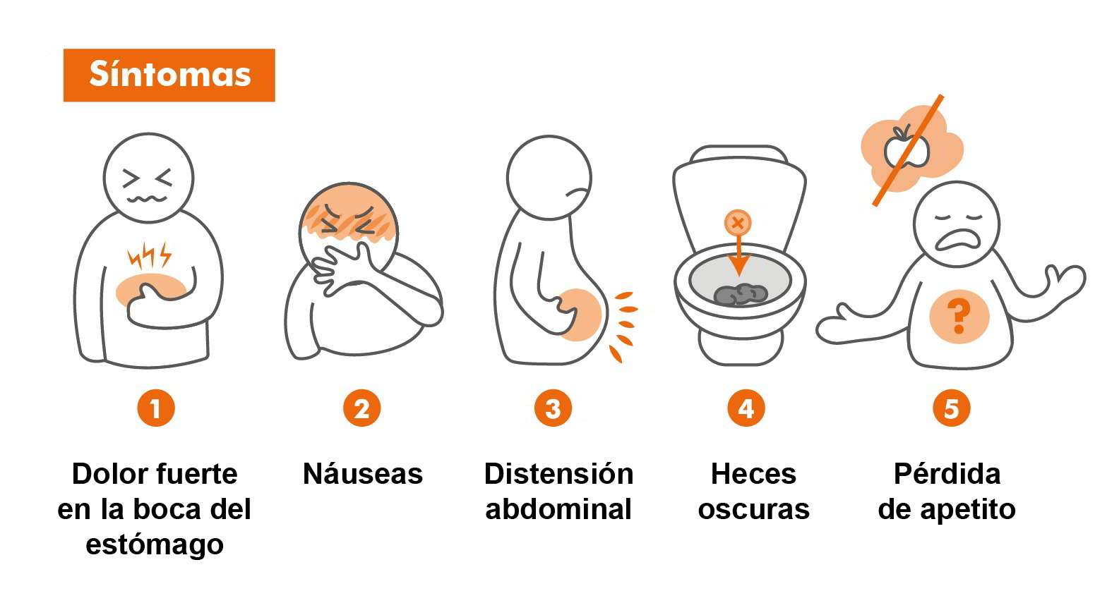 Infografía de síntomas de la gastritis: dolor en la boca del estómago, náuseas, distensión abdominal, heces oscuras y pérdida de apetito